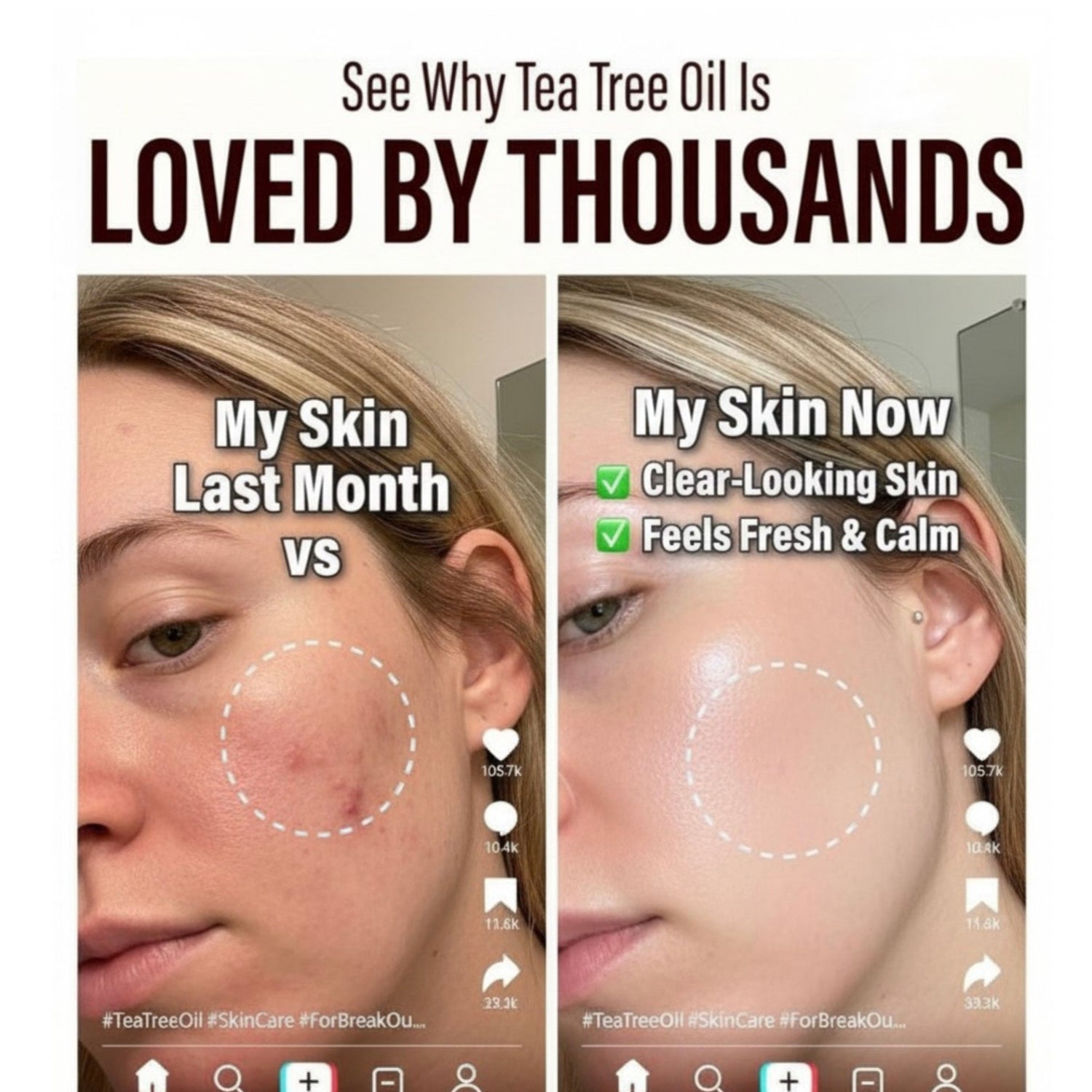 Tea Tree Essential Oil